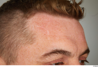 Steve Q head scar skin 0001.jpg